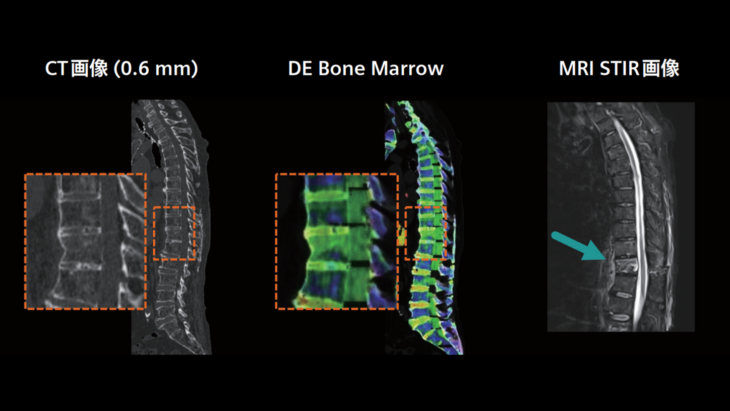 JP-CT-Pro.Pulse_CaseRport_vol.4-2