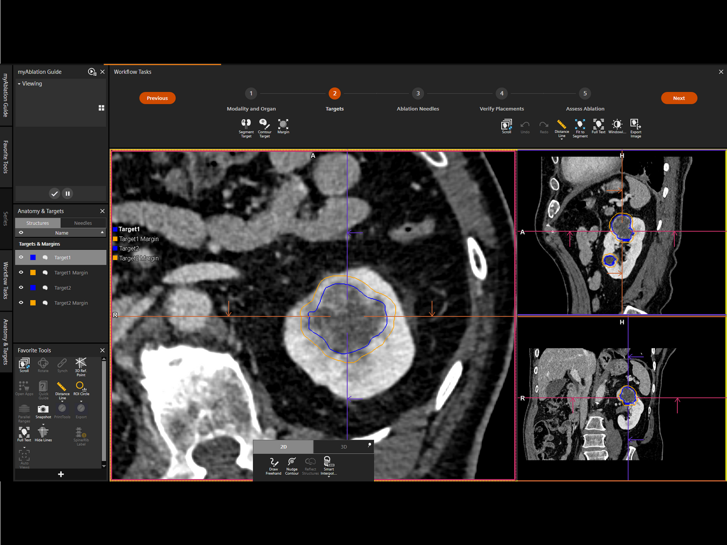 Immediate postprocedural assessment