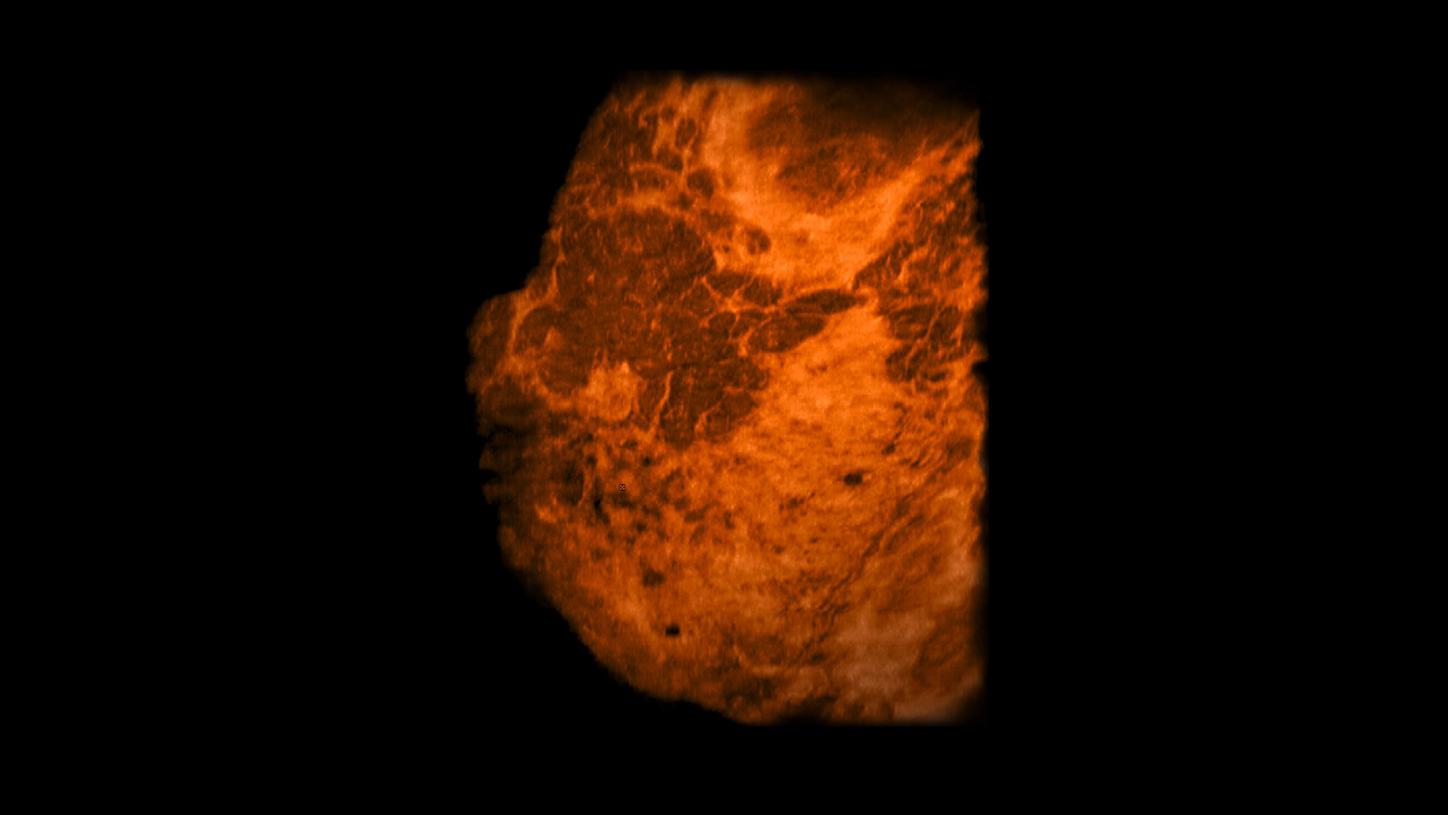 img prod-serv oncologia