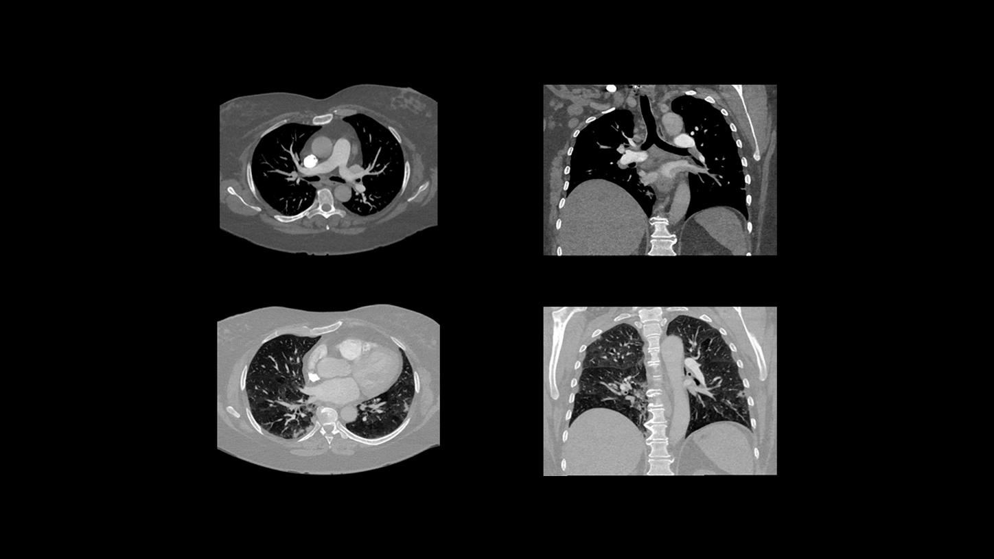 Vascular Imaging