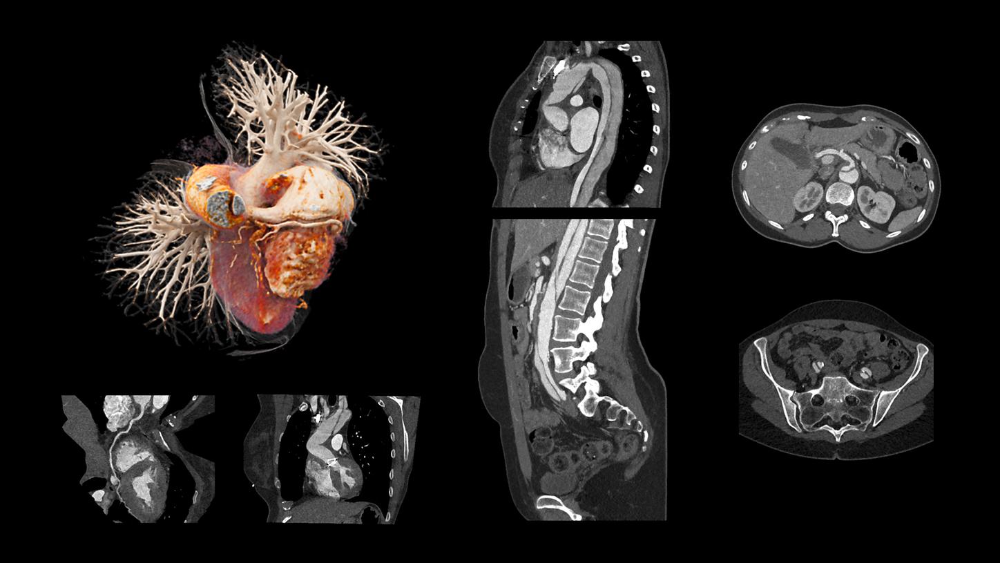 SOMATOM Edge Plus - Clinical Image