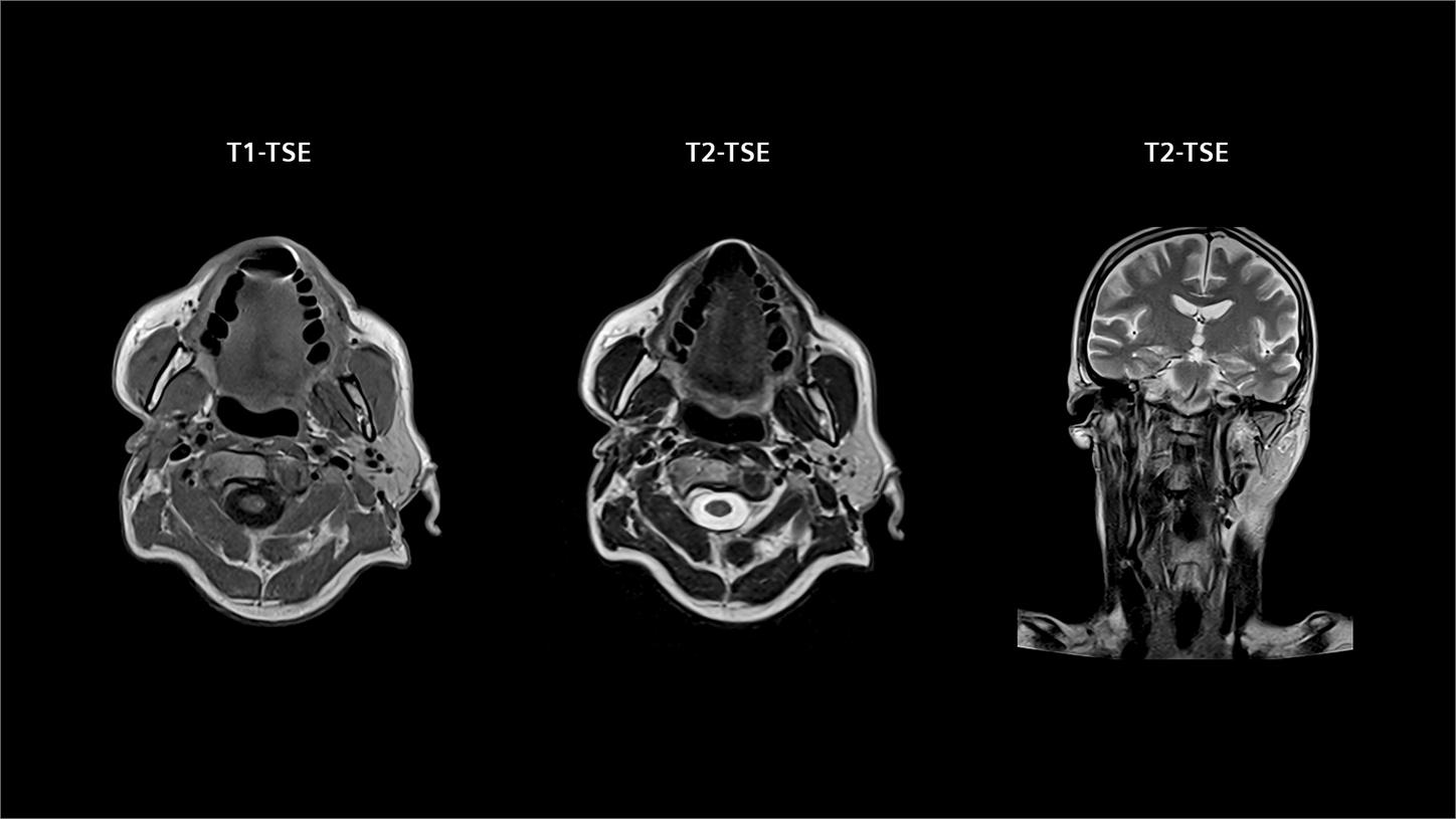 High-resolution MRI image of a head and neck