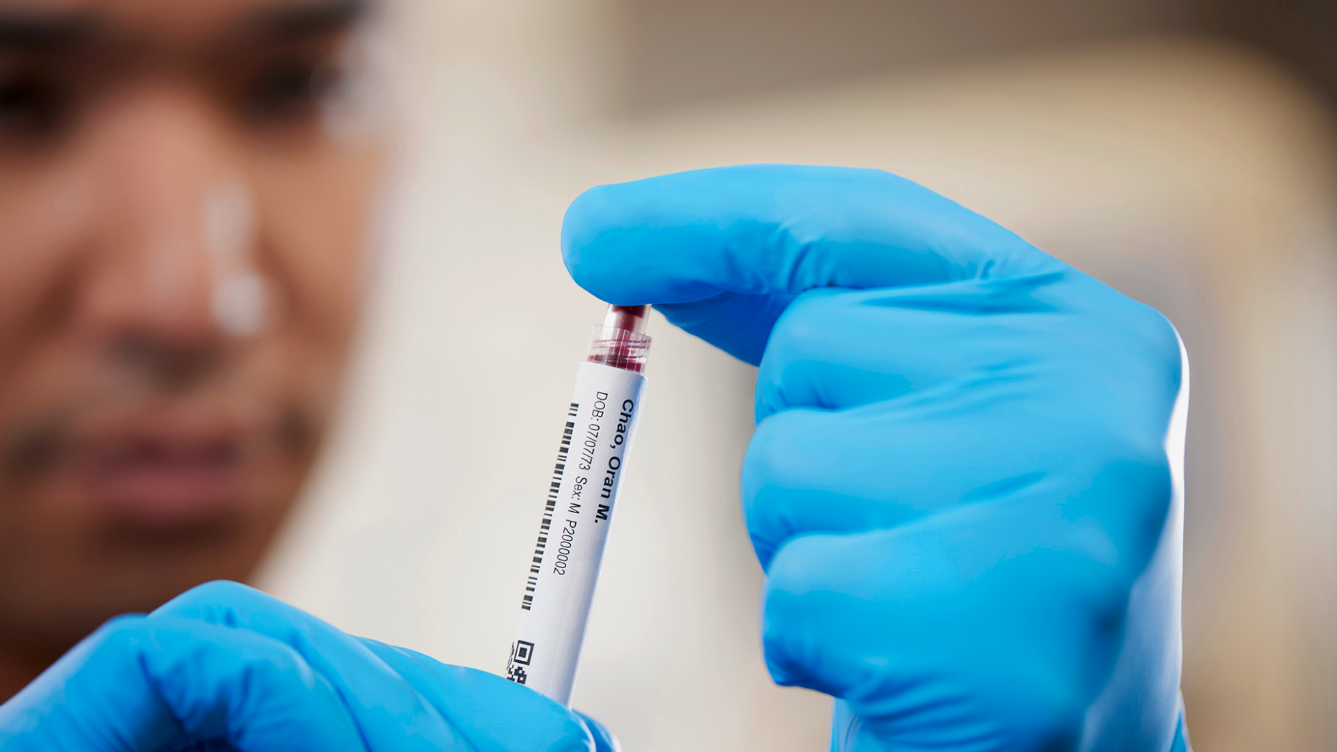 Medical Device Sampling Methods Preanalytical sampling devices - Siemens Healthineers