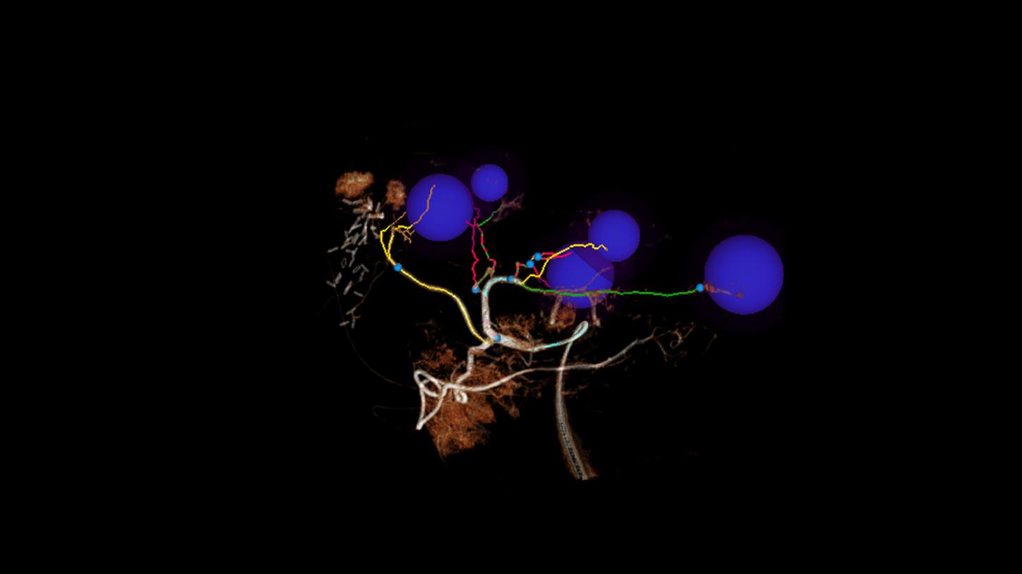 Clinical software for interventional radiology
