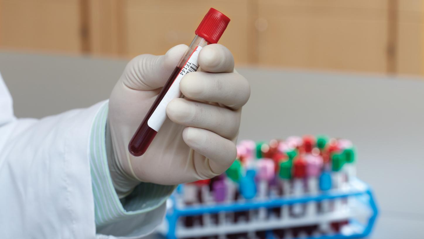 ELF test test tube