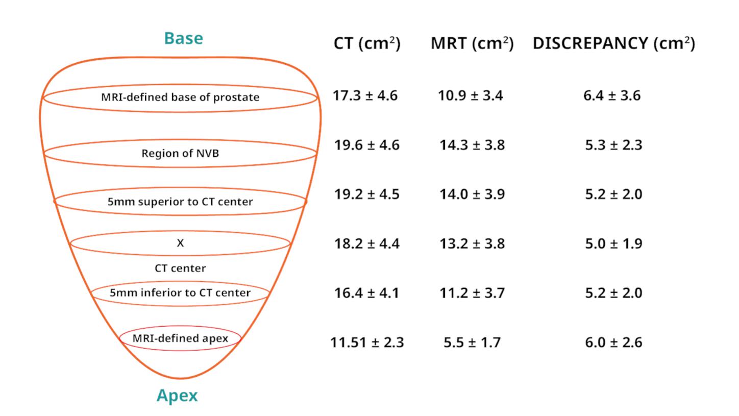Comparison of the prostate area at six levels using superimposed axial MR and CT images (mean ± SD) (adapted from Strahlenther Onkol.3 Copyright 2011 Springer Medicine).