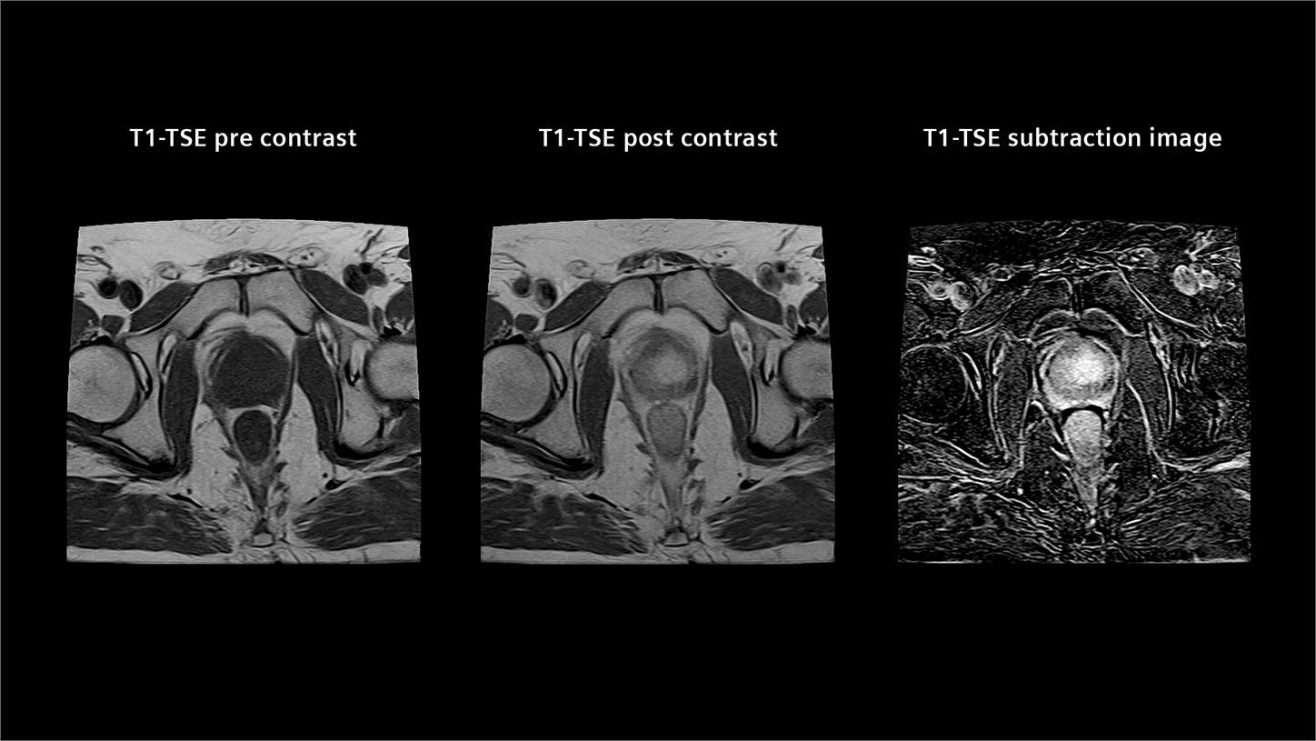Detailed male pelvic image