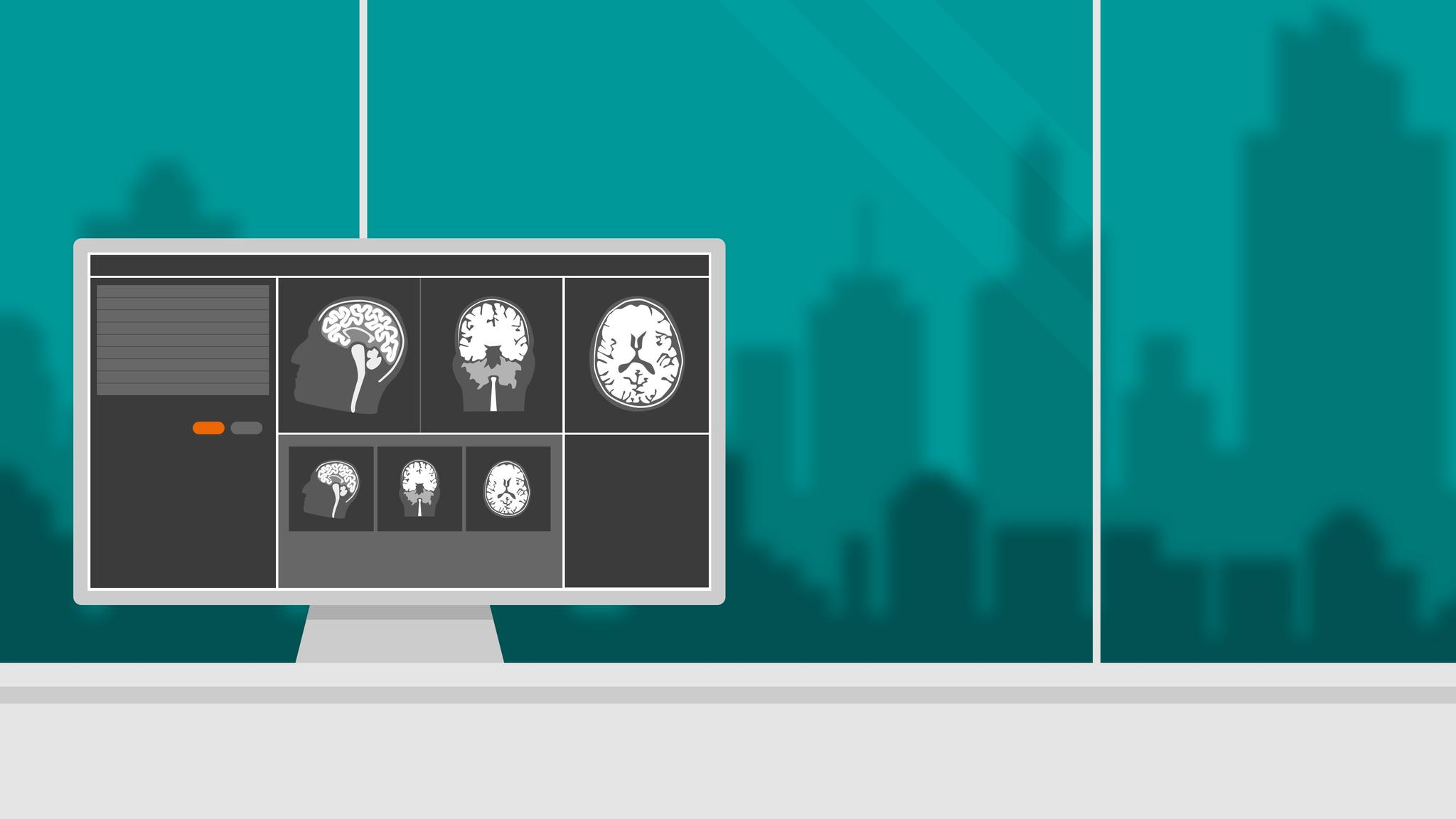 Evolve Program MR XA30 - Siemens Healthineers USA