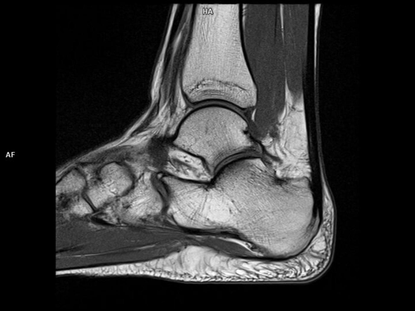 T1 TSE Sag-MAGNETOM Sola