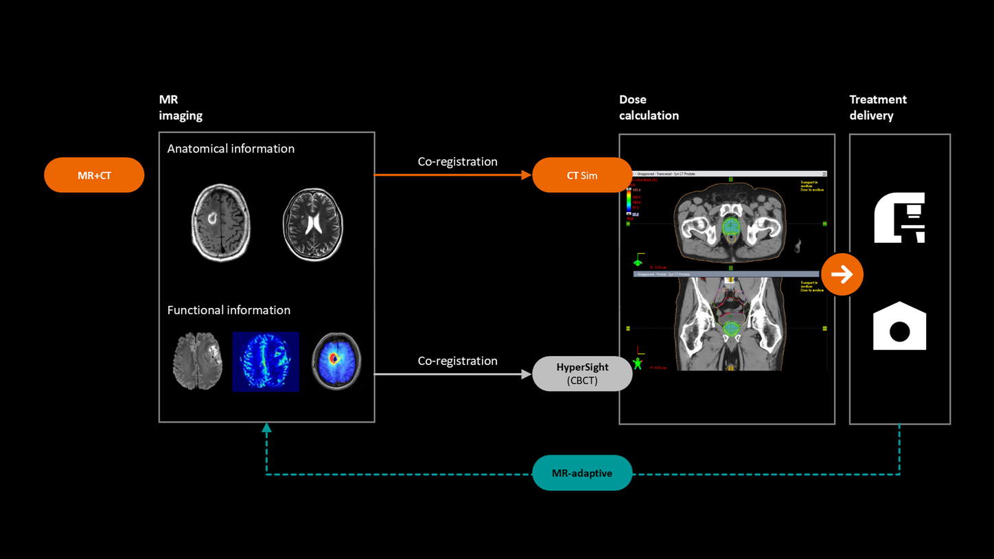 JP-CTH-mri-radiation-therapy-magnetom-flow-rt-pro-edition_workflow-possibilities
