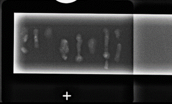 Aquisição em imagem scout a zero graus