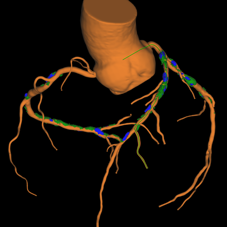 Courtesy of National Institute of Cardiology Warsaw, Poland