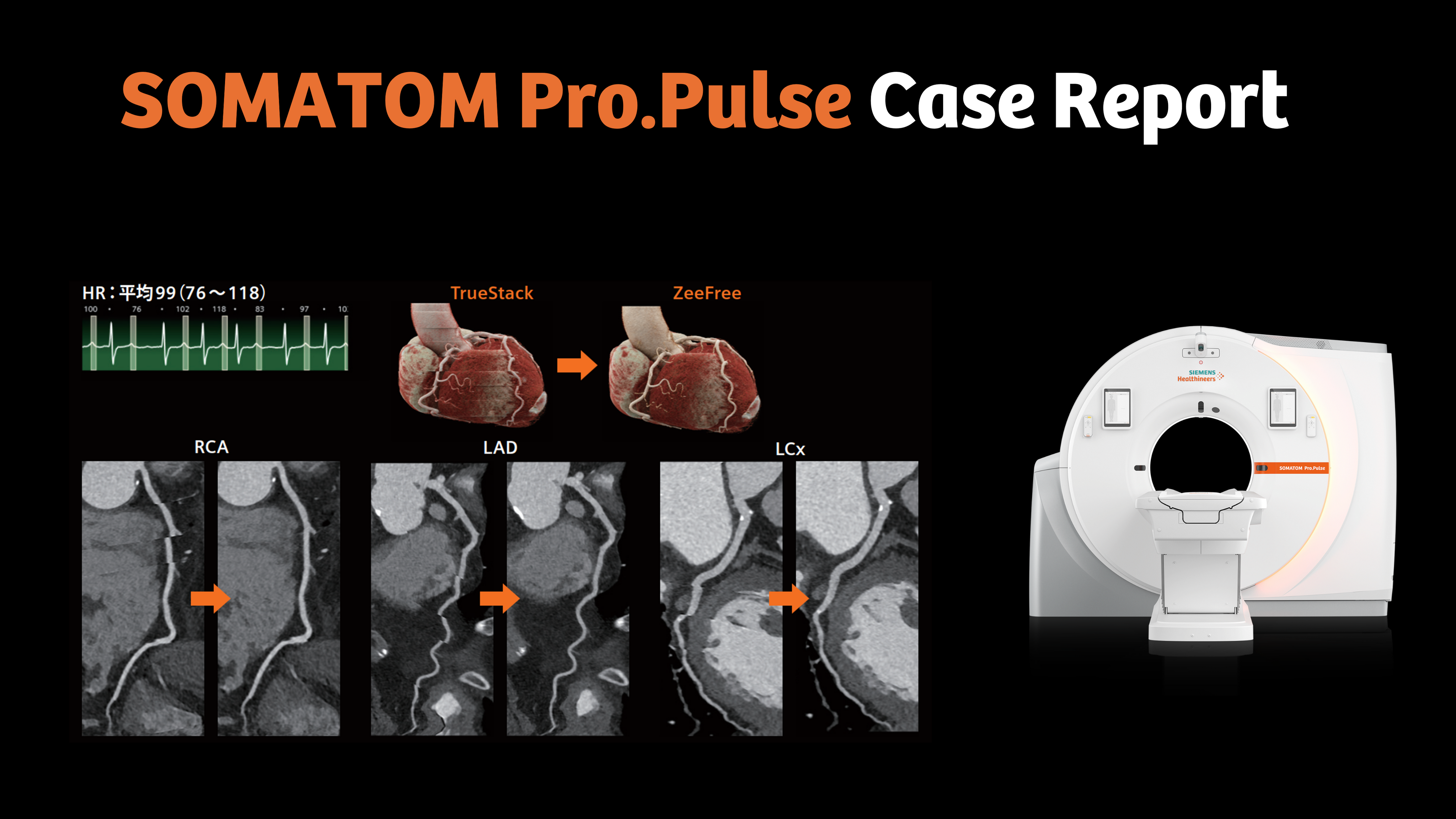 JP-Pro.Pulse_casereport1_image
