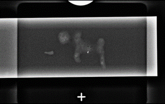 Aquisição em imagem scout a zero graus