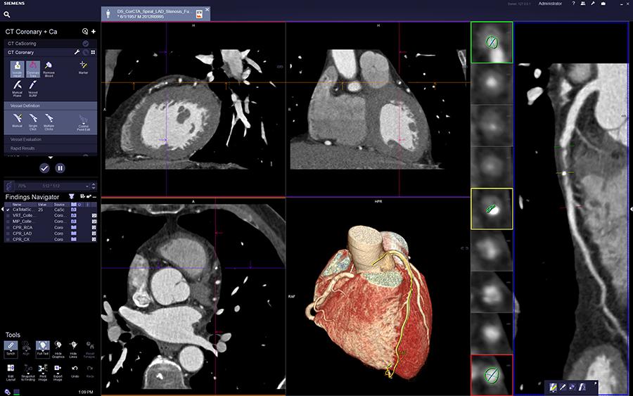 syngo.via for Modality Computed Tomography