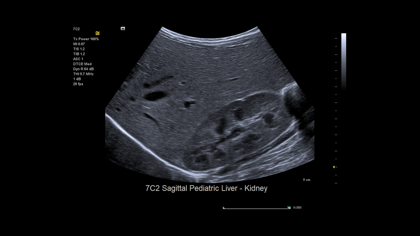 ACUSON Juniper is a High-Performance Shared Service Ultrasound