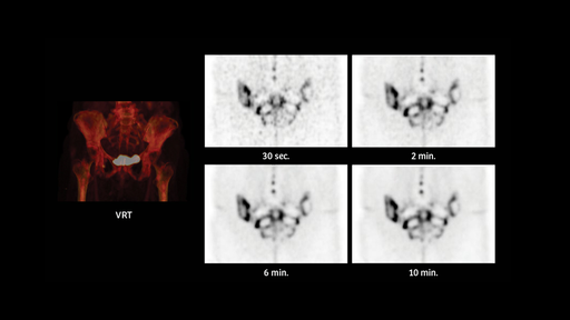 A Quantum Leap In PET/CT Imaging - Siemens Healthineers