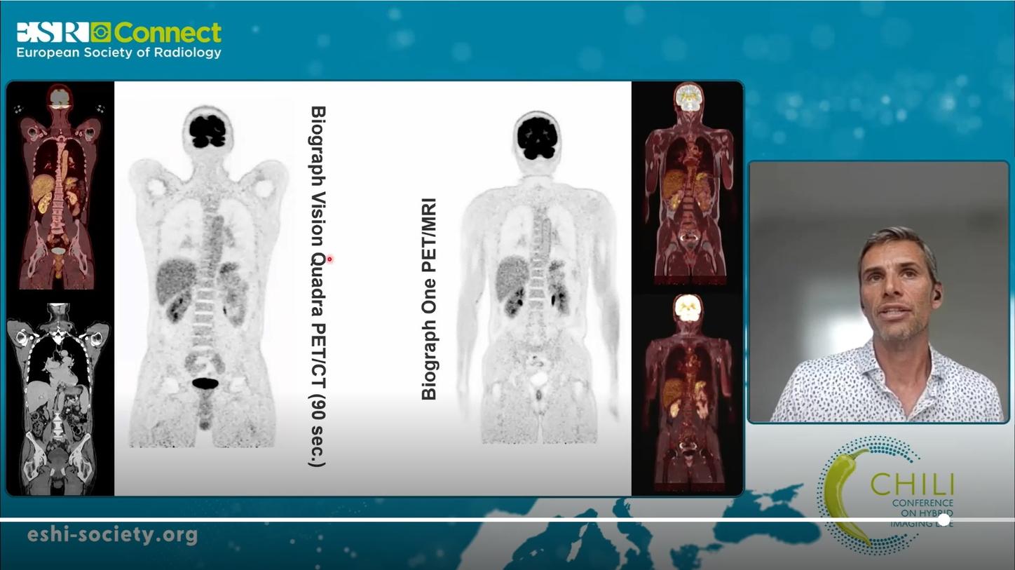 Preview Clinical Talk Adrienne Campbell-Washburn