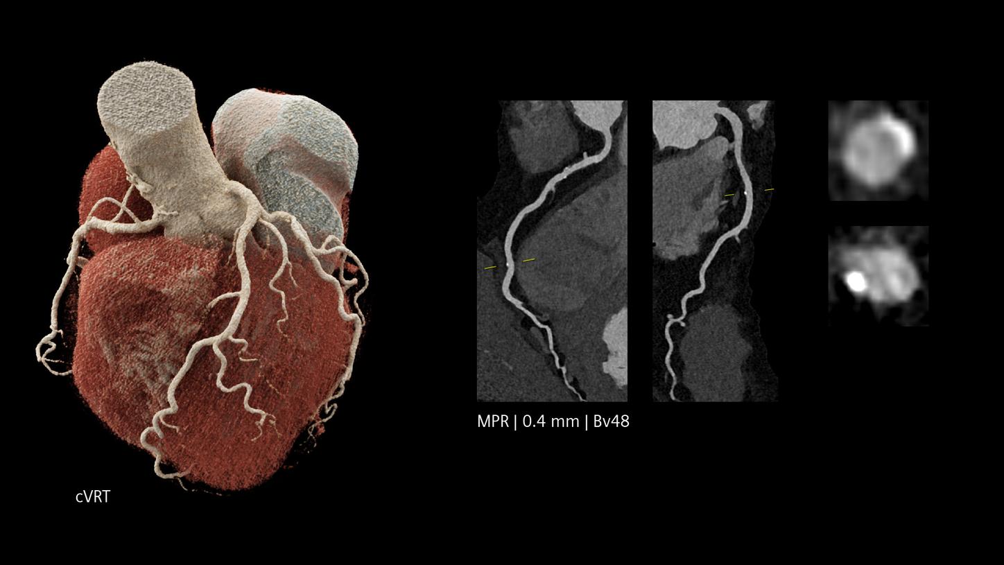 Cardiac CT images showing coronary artery details and a 3D heart model, with scan parameters listed below.