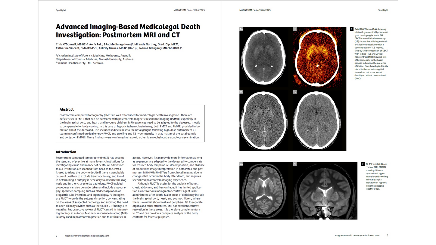 Sienems-Healthineers_Magnetomworled_O-Donnell1