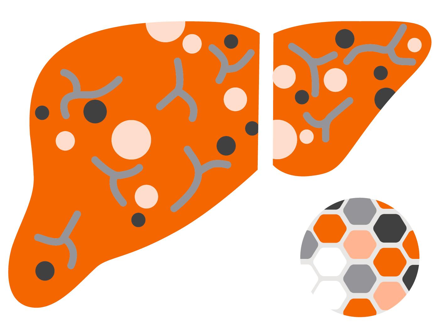 Fibrotic Liver