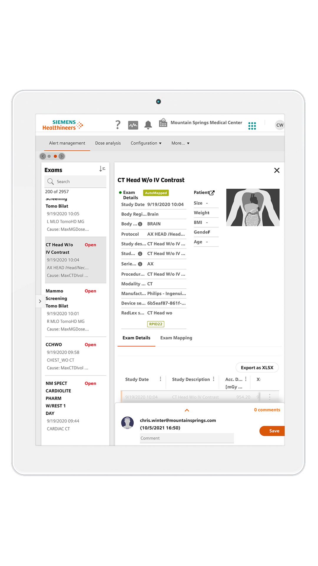 teamplay Dose report example 2