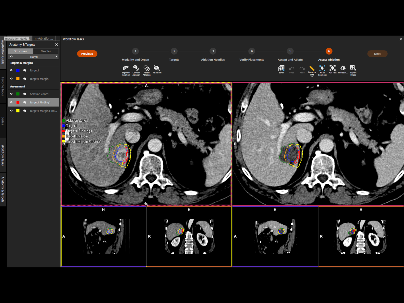 Immediate postprocedural assessment