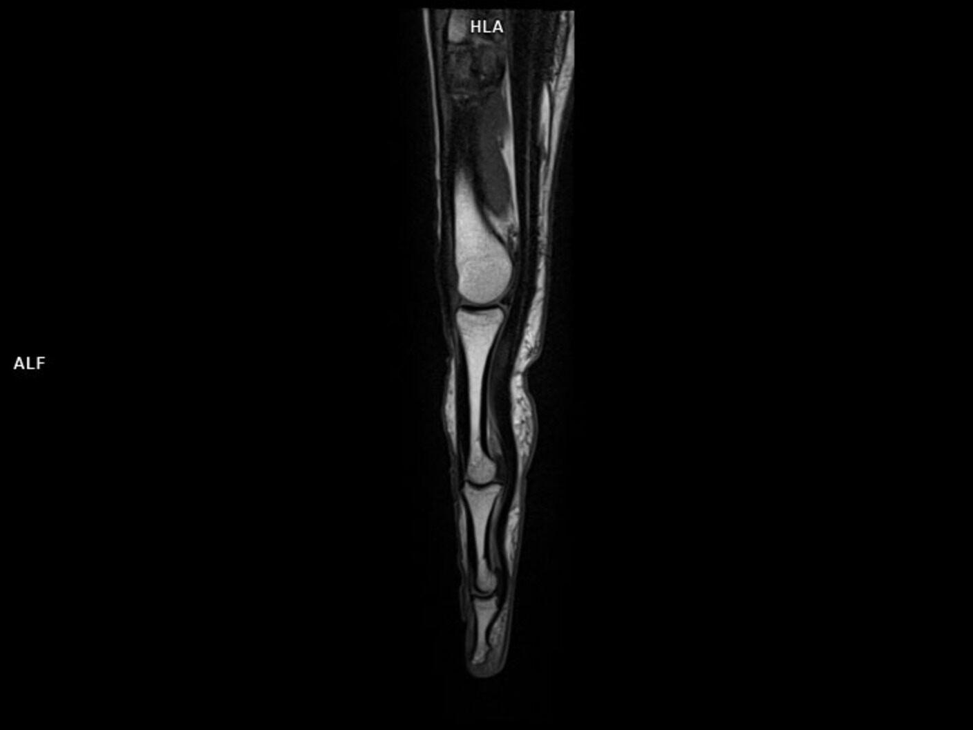 Sagittal T1 TSE-MAGNETOM Lumina