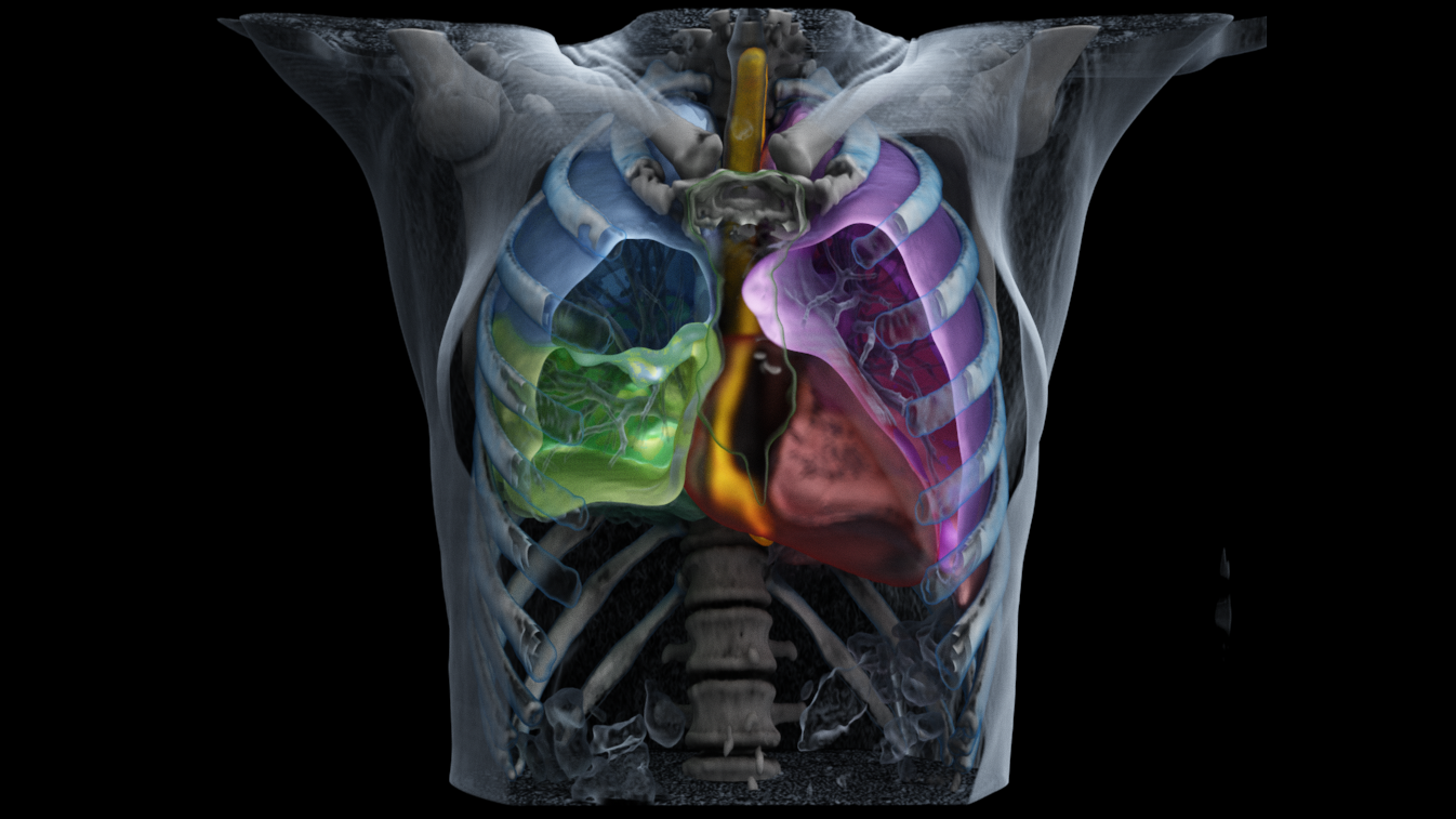 Autocontouring solutions