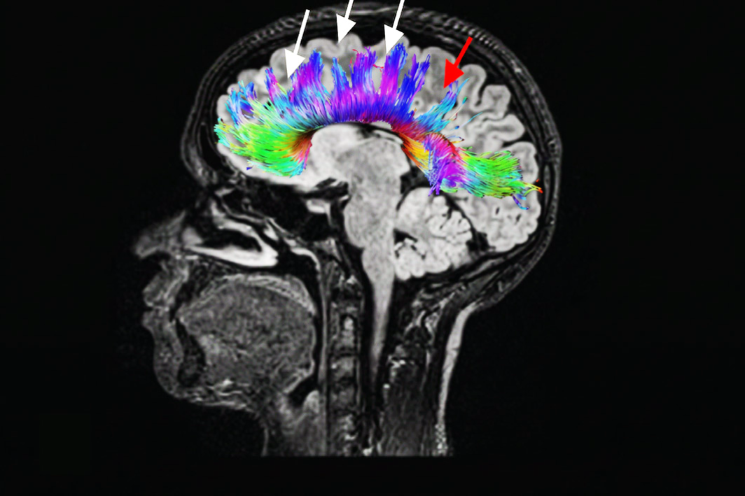 Fig J - MRI