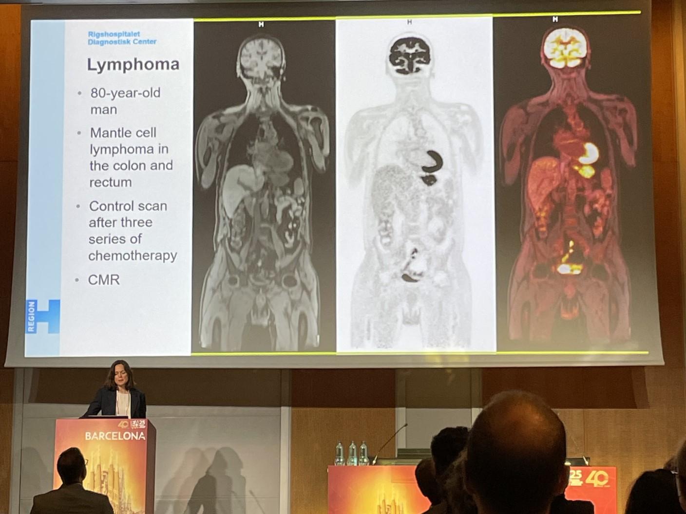 Kirsten Korsholm, MD, PhD, from Rigshospitalet, Denmark.