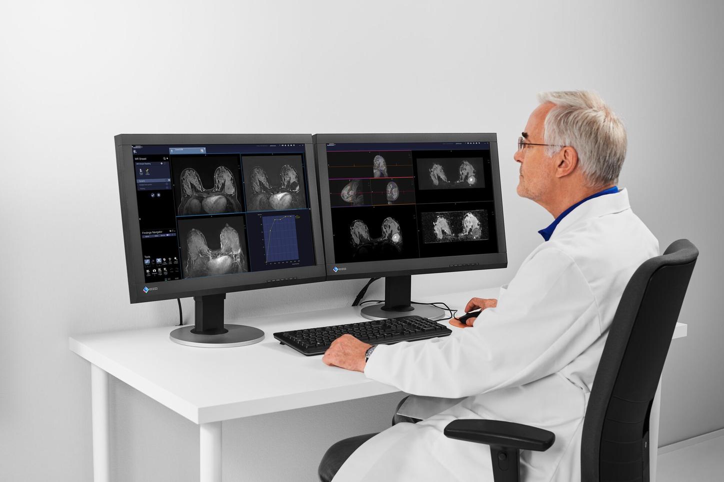 Ilustración de Resonancia Magnética de mama