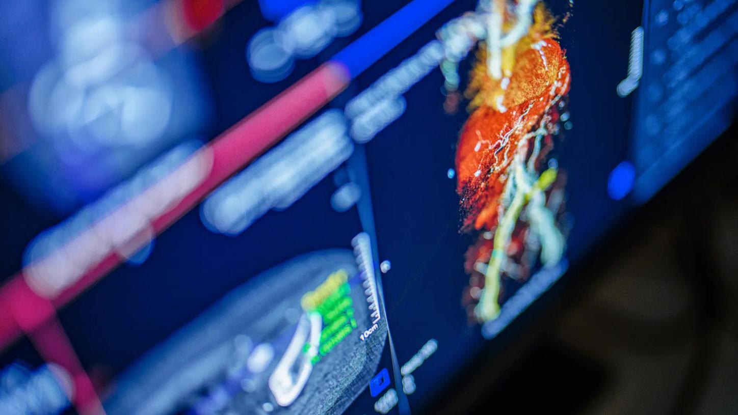 Healthcare AI