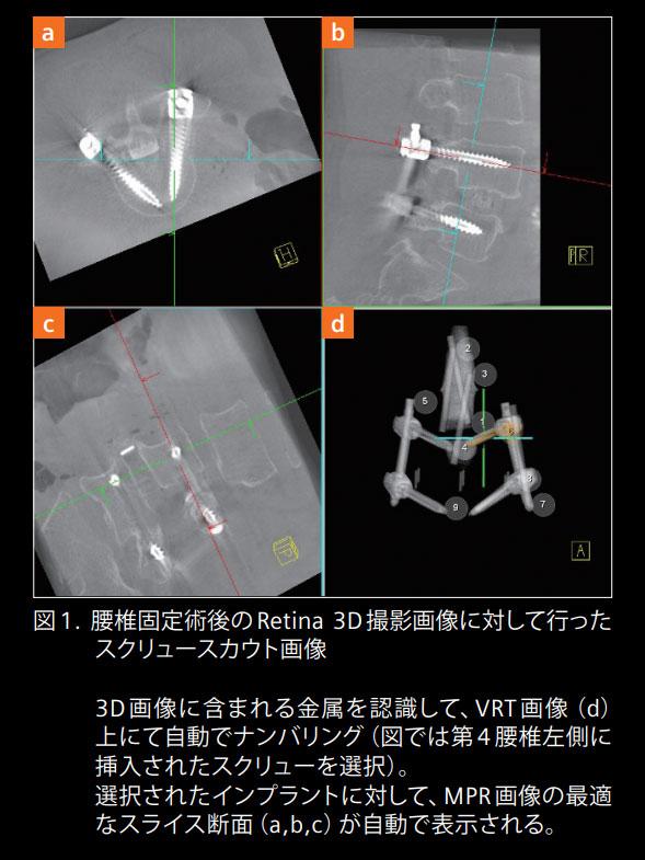 大室整形クリニック臨床画像
