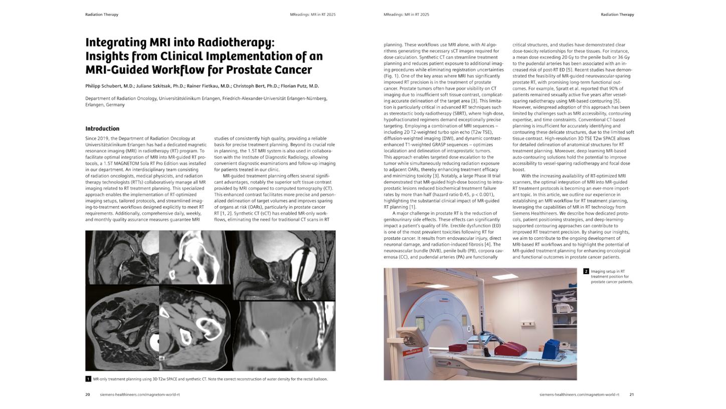 Teaser Image for the arcticle Integrating MRI into Radiotherapy