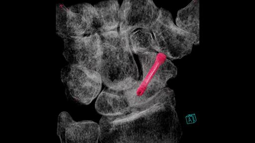 Multitom Rax | Move beyond traditional X-ray - Siemens Healthineers