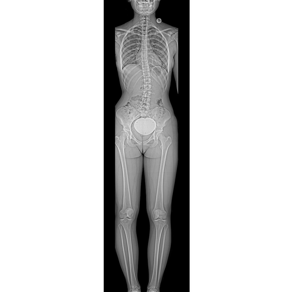 Twin Robotic X-ray scanner – Multitom Rax - Siemens Healthineers USA