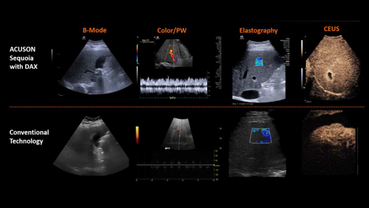 DAX transducer vs conventional ultrasound