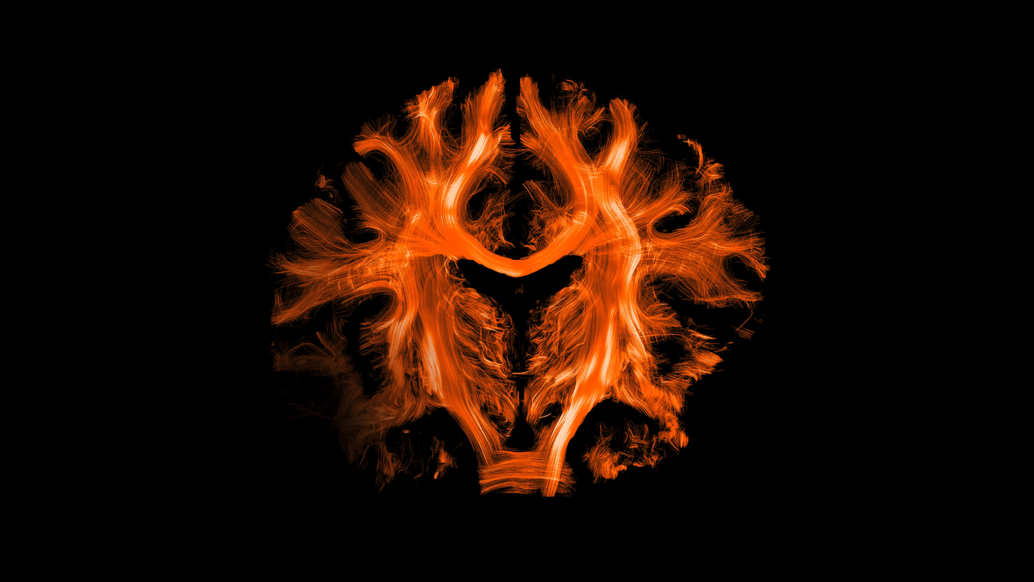 Research-Call-Microstructure MRI