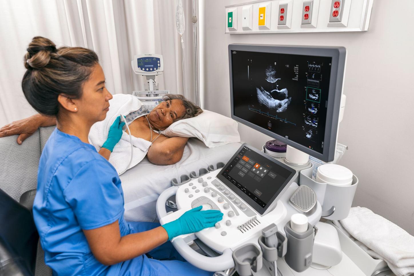 ACUSON Origin Cardio