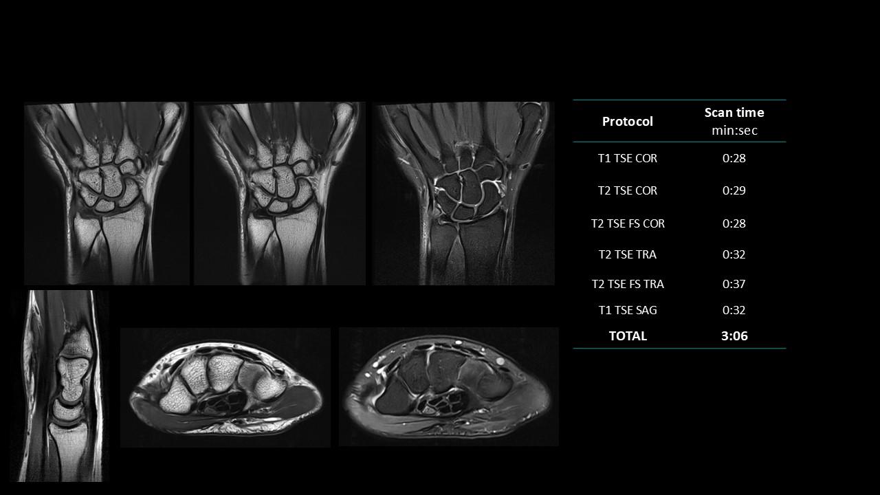 siemens-healthineers_magnetomworld_Wrist-rountine