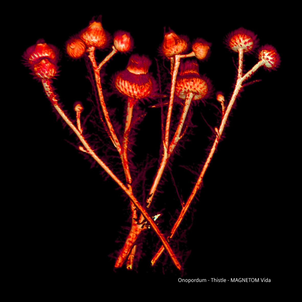 Siemens-healthineers_Magnetomworld_Thistle_coloured_Vida