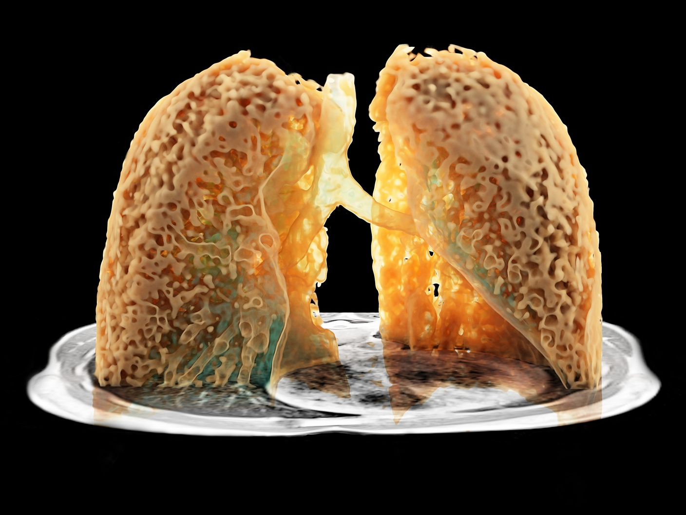 MR Pulmonary MRI 4x3