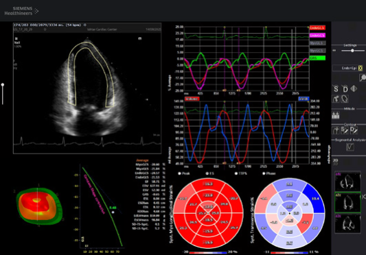 Strain Imaging Findings