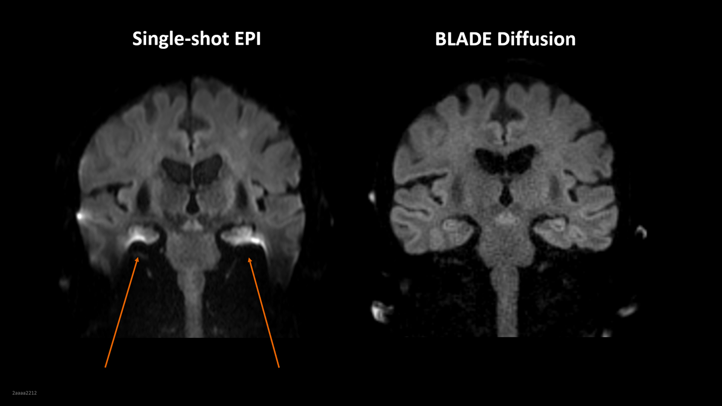 BLADE Diffusion