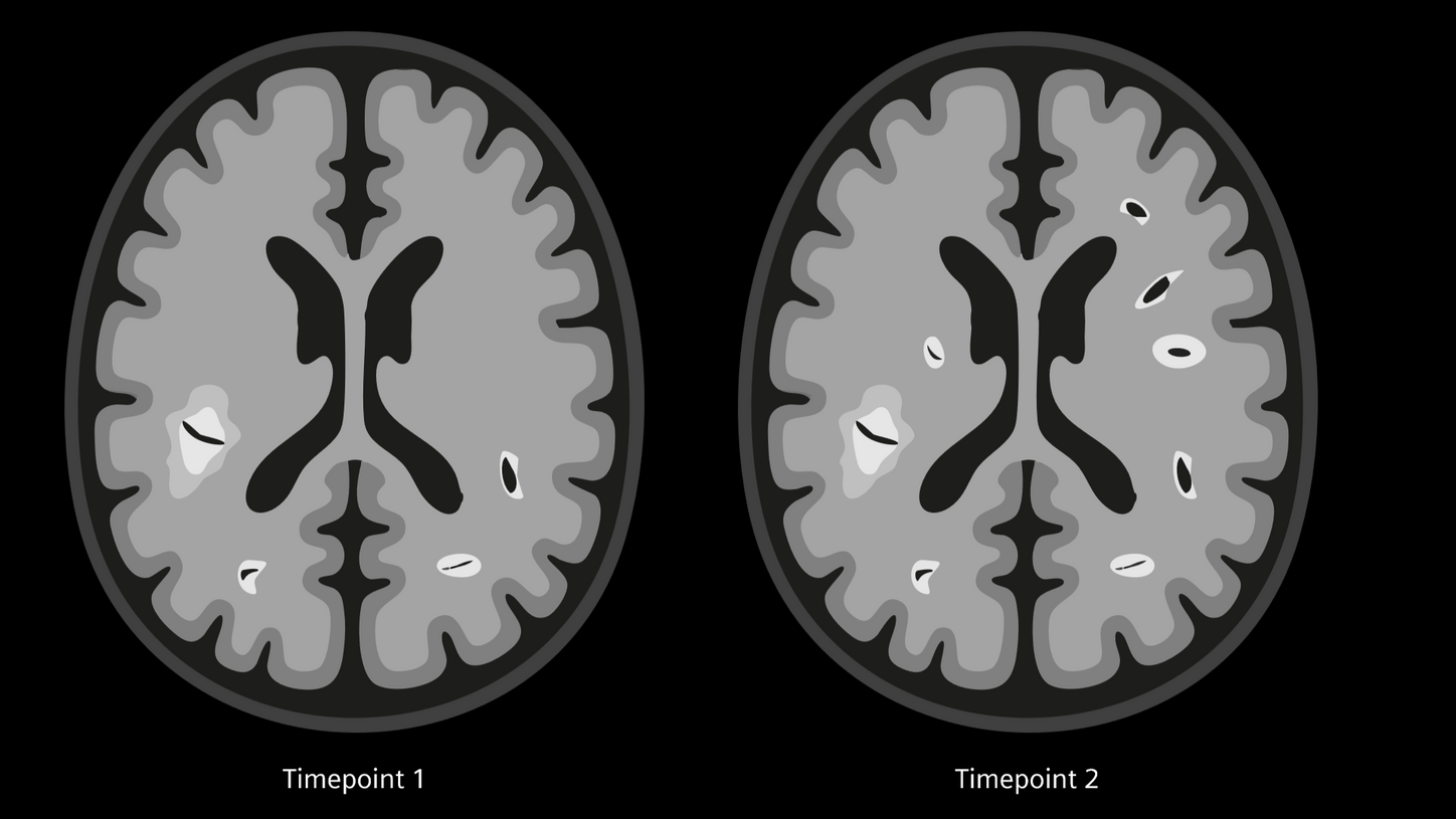 Dissemination in time (DIT)