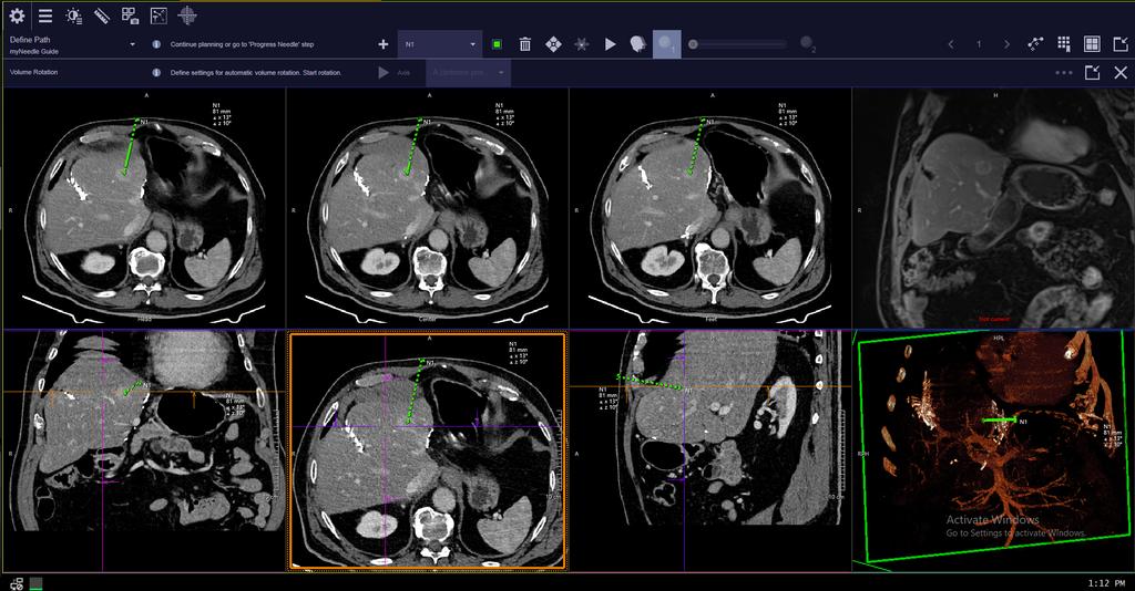 CT scanner SOMATOM go.Top eco with myExam Companion - Siemens Healthineers