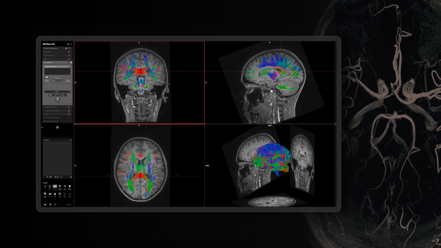 syngo.via key visual mood device and clinical