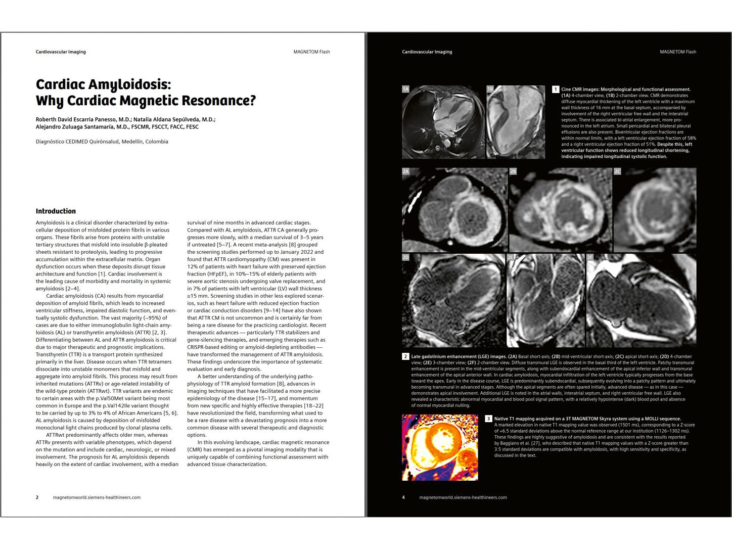 Siemens-healthineers_Magnetomworld_Zuluaga_CMR