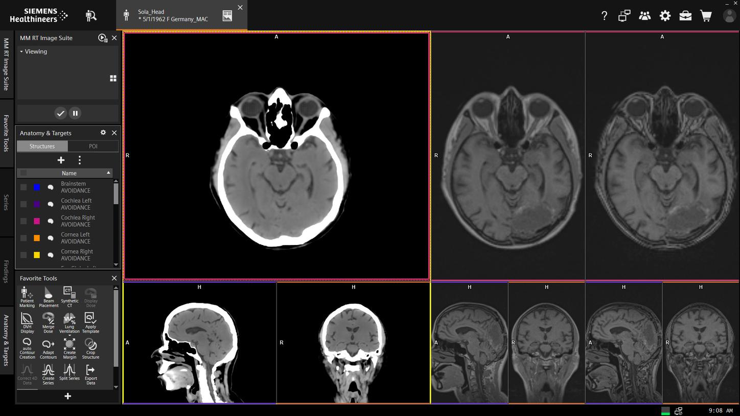 Siemens Healthineers syngo.via RT Image Suite Synthetic CT